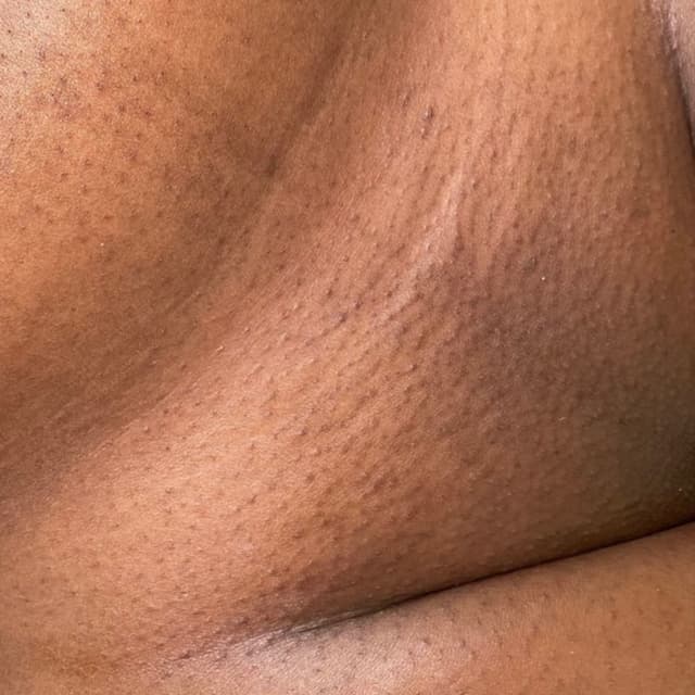 Brazilian Membership*